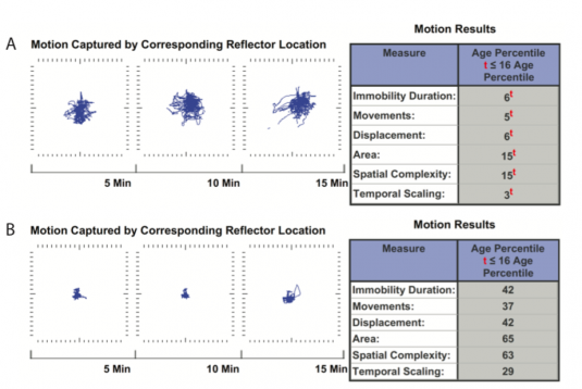 Harvard-Studie unterstützt Sensorik- und Motoriktraining bei ADHS